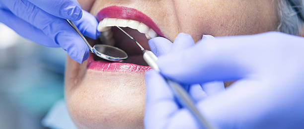 Best Emergency Dentist for Knocked-Out Tooth in Brenham, TX